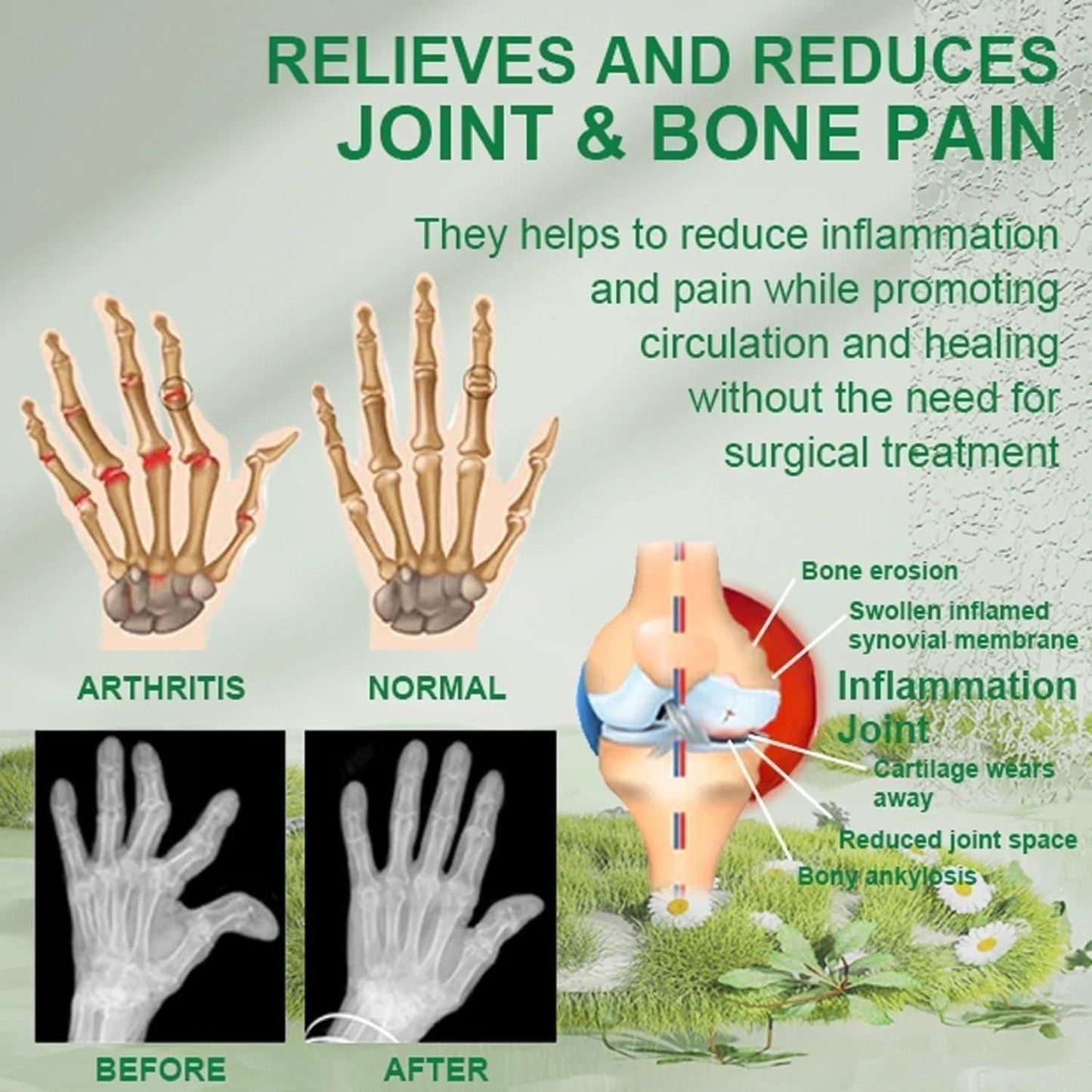 Bee Venom Pain Relief Cream For Strong Ayurvedic Joint Pain Relief Oil, Knee Pain, Neck Pain, Back Pain, Shoulder Pain (Pack of 2)