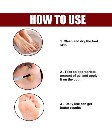 Feet Corn Removal Serum 30ml ( Pack Of 1 )