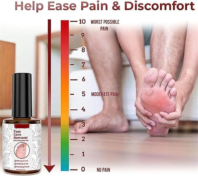 Feet Corn Removal Serum 30ml ( Pack Of 1 )