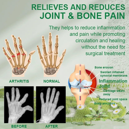 Bee Venom Pain Relief Cream For Strong Ayurvedic Joint Pain Relief Oil, Knee Pain, Neck Pain, Back Pain, Shoulder Pain (Pack of 2)