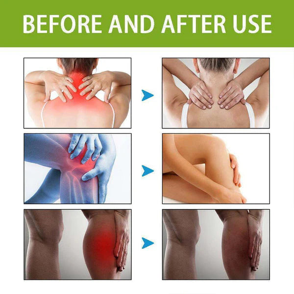 Bee Venom Pain Relief Cream For Strong Ayurvedic Joint Pain Relief Oil, Knee Pain, Neck Pain, Back Pain, Shoulder Pain (Pack of 2)